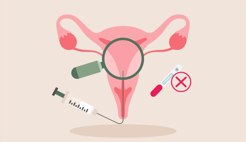 Implantation Failure: Complete Guide to Causes, Diagnosis, Treatment, and Prevention